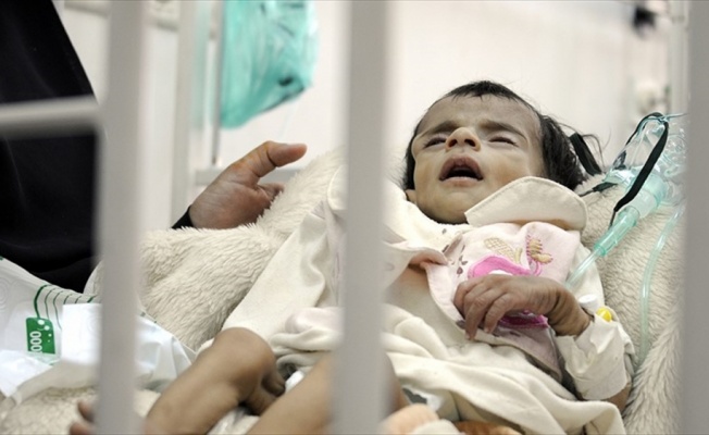 Yemen'de yarım milyon çocuk ölüm tehlikesiyle karşı karşıya