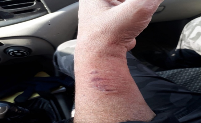 Polis memurunun kolunu ısıran HDP’li vekile soruşturma