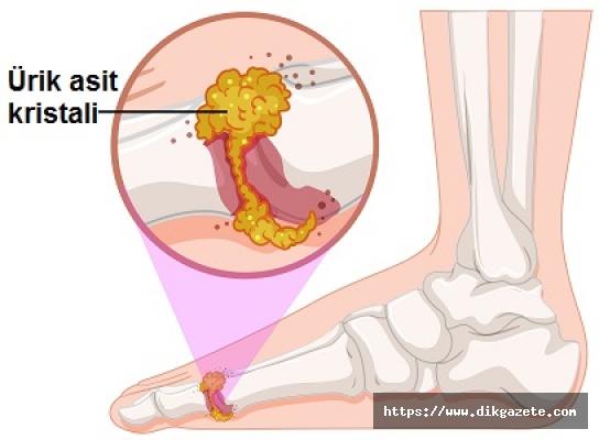 “Menopoz sonrası gut hastalığına dikkat“