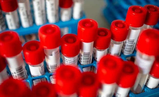 Sağlık Bakanlığı Referans Laboratuvarı'nda Kovid-19 virüsü izole edildi