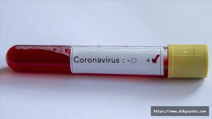 Türkiye'de son 24 saatte 61 kişi koronavirüs sebebiyle yaşamını yitirdi