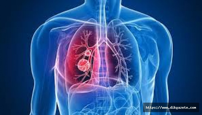 Ailesinde akciğer kanseri olanlar 2,4 kat daha fazla risk taşıyor
