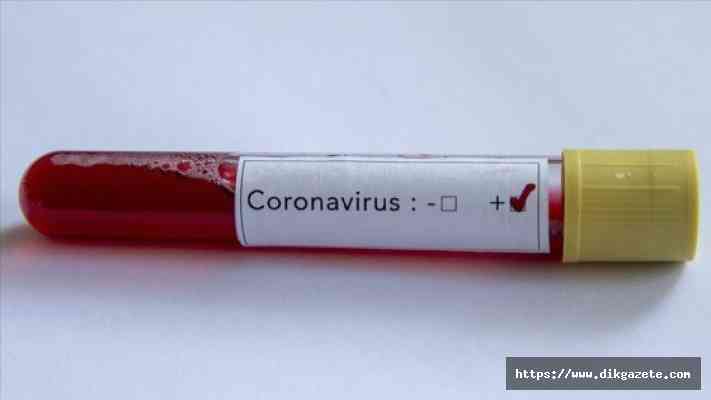 Pandemide ikinci dalga “koronavirüse karşı güven sertifikalarına“ ilgiyi artırdı