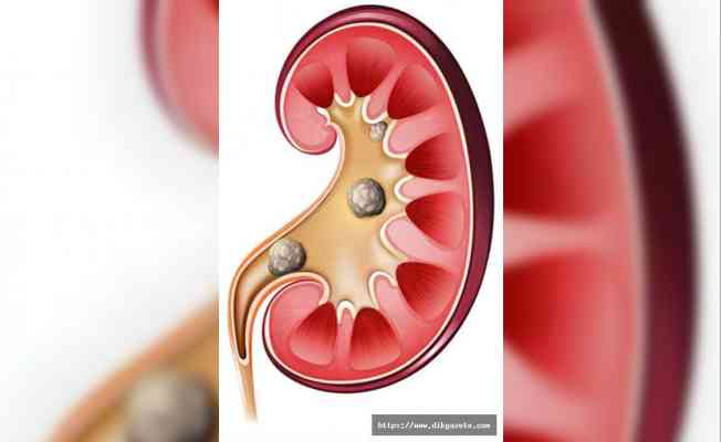 “Böbrek yetmezliğinde salgının geçmesini beklemeyin“ uyarısı
