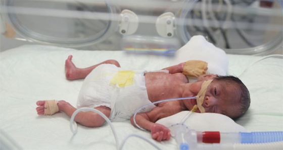 Erciyes'te ve dünyada bir ilk! 750 gram bebeğe operasyon
