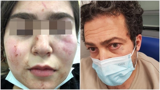 Almanya&#039;da polis 17 yaşındaki Türk kızını ve babasını hastanelik etti