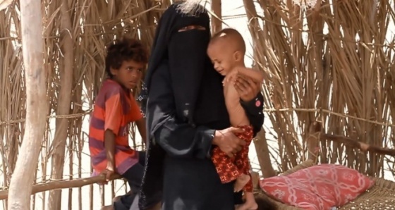 BM'den acı açıklama: Yemen savaşında 2 yılda bin 500 çocuk öldü