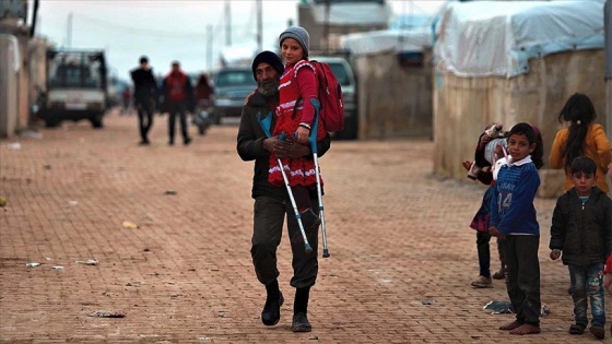 Esed rejiminin saldırısında bacağını kaybeden Esra protez bacak hayaliyle yaşıyor