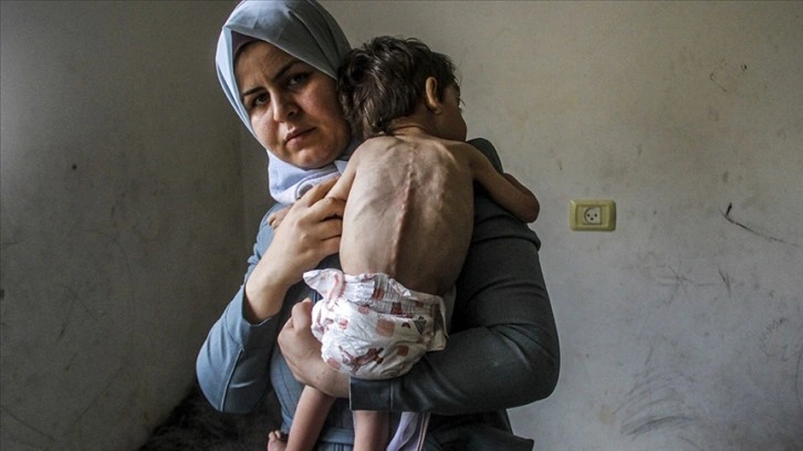 Gazze Şeridi'nde 3 bin 500 çocuk yetersiz beslenme nedeniyle ölüm tehlikesi altında