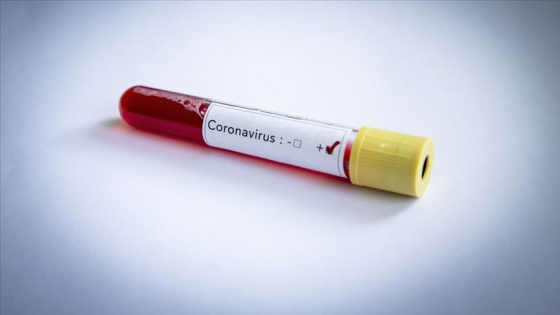 Gine Bissau'da Başbakan ve 3 kabine üyesi Kovid-19/ koronavirüse yakalandı
