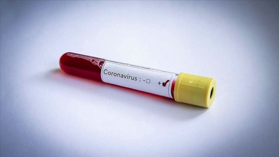 Hollanda'da Kovid-19/ koronavirüs sebebiyle ölenlerin sayısı 771'e yükseldi