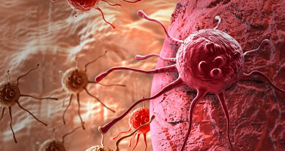 Jinekolojik kanserlere karşı öneriler