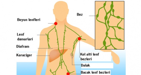 Lenf bezi şişmesi, büyümesi, nedenleri, belirtileri ve tedavisi