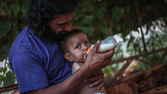 Uzuvları olmayan Muhammed bebek, tutunacak bir hayat arıyor