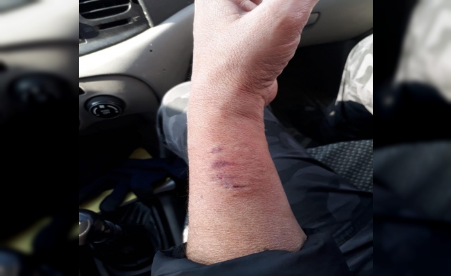 HDP’li vekil polis memurunun kolunu ısırdı