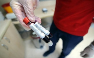 Kanserle mücadelenin yeni silahı: kan testleri