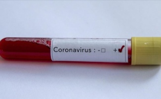Kovid-19/ koronavirüse karşı &#39;yeşil koridor&#39; ve &#39;görev gücü&#39; önerisi