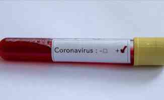 Pandemide ikinci dalga “koronavirüse karşı güven sertifikalarına“ ilgiyi artırdı