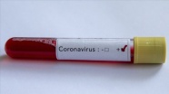Almanya&#039;da günde 200 bin koronavirüs testi yapılması amaçlanıyor