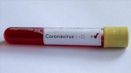 Ekvador&#039;da koronavirüs nedeniyle ilk ölüm gerçekleşti