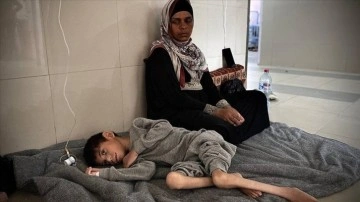 Filistinli doktor, Gazze'deki hastanelerin yetersiz beslenme vakalarıyla dolu olduğunu söyledi