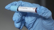 Gana'da ilk yeni tip koronavirüs vakaları görüldü