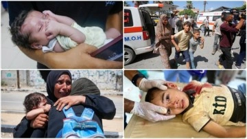 Gazze'deki yabancı doktorlar, İsrail'in şarapnel etkili bombalarının çocuklara etkisini anlattı