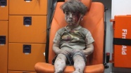 Halep'li 5 yaşındaki ''Ümran Daknes''in dramı herkesi etkiledi