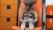 'Halep'te Ümran gibi 100 binden fazla çocuk var'