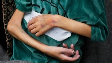 İsrail saldırıları altındaki Gazze'de bir haftada 4 çocuk daha "açlıktan" öldü