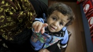 Kalbi delik Suriyeli Mahir bebek Türk doktorlarına emanet