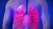 Kovid-19 geçiren hastaların akciğerleri ksenon gazı kullanılarak yeni bir yöntemle tarandı