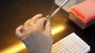 Laboratuvarda insan midesine ait dokular geliştirildi