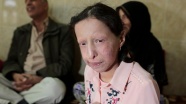 Nadir hastalığa yakalanan Suriyeli Zeve ölmek istemiyor