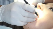 'Onkoloji tedavisi öncesinde diş kontrolü' uyarısı