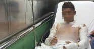 Samsun'da çakmak gazı parladı: 4 çocuk yaralı