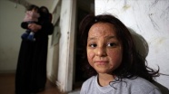 Savaşın izini bombardımanda yanan yüzünde taşıyan küçük Latife aynaya mutlu bakmak istiyor