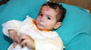 Suriyeli Ala bebek Sivas'ta yaşama tutundu