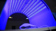 Taşınabilir fototerapi cihazıyla evde 'mavi ışık' tedavisi dönemi