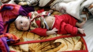Yemen'de 10 milyon çocuk acil yardıma muhtaç