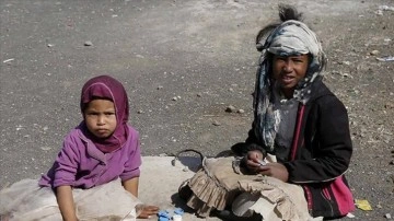 Yemen'de çocukların yüzde 50'sinde kronik yetersiz beslenme görülüyor