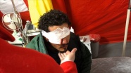 Yunanistan&#039;ın attığı plastik mermi sığınmacıyı gözünden etti